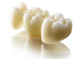 Безметалловая керамика в стоматологии. Преимущества и недостатки
